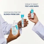 ژل پاک‌کننده ضد جوش سراوی سراوی Acne Blemish Control Cleanser
