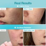 ماسک ورقه ای پانتوتنیک B5 و هیالورونیک نامبوزین Pantothenic B5+Hyaluronic Acid No.1